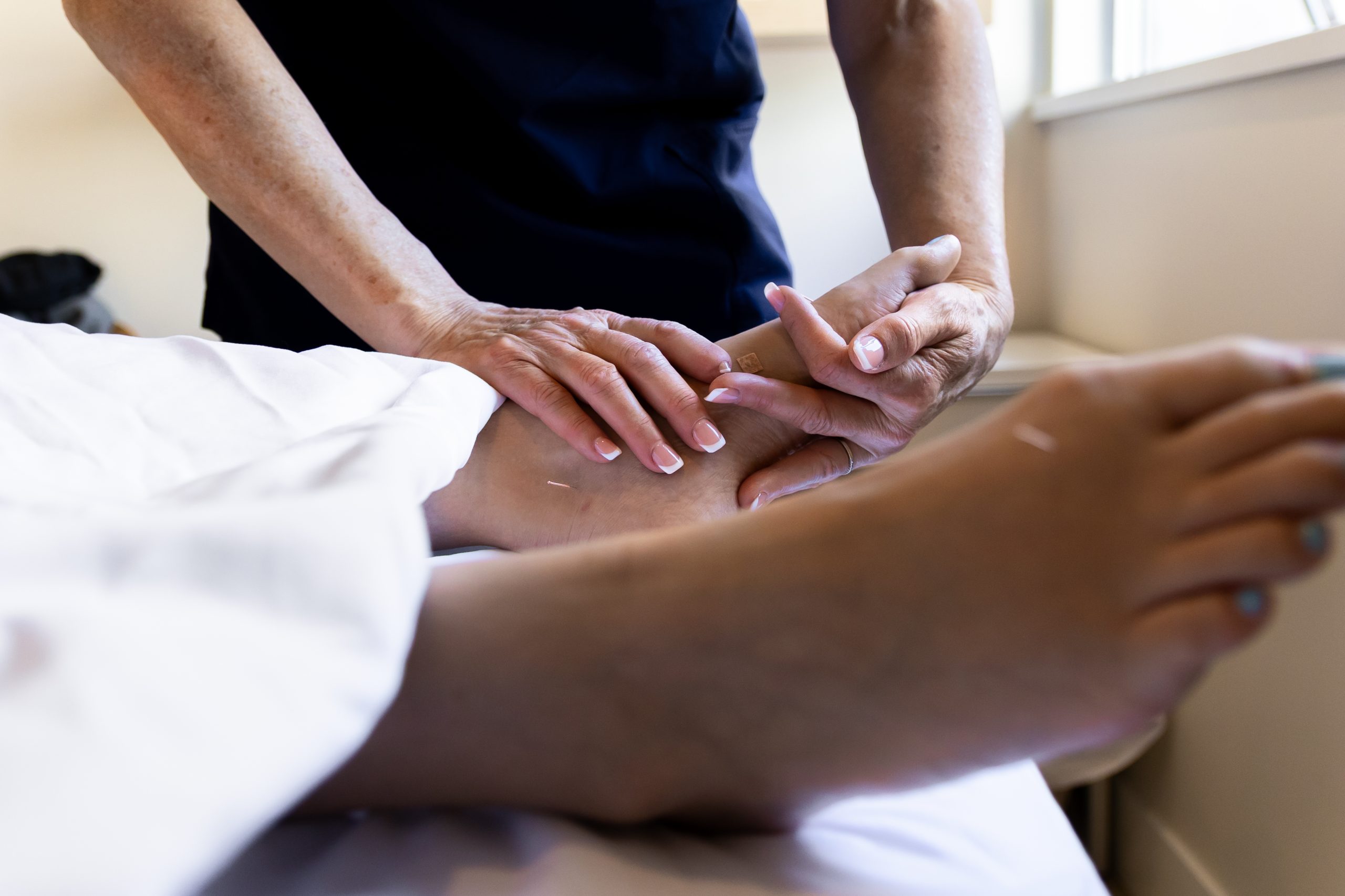 Acupuncture needles being applied to patient